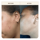 Apoterra Vetiver Illuminating Oil Cleanser soap with natural vetiver oil, shown in before and after skincare comparison images.